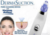 4-in-1 Facial Suction Blackhead Remover – Acne & Pore Cleaner | Elitecartt