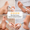 Vexnoraa Electric Foot Callus Remover